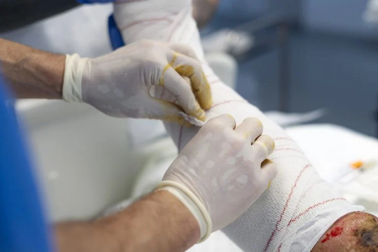 Projeto de Lei Garante Assistência Integral e Cirurgias Reparadoras para Vítimas de Queimaduras no Brasil
